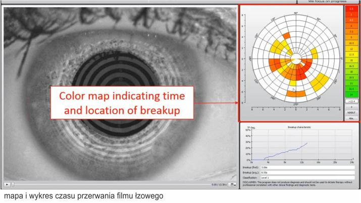 mapa i wykres czasu przerwania filmu łzowego - badanie nibut Wrocław